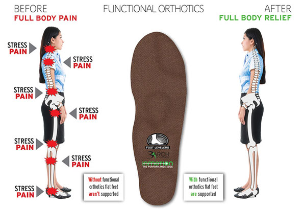 Custom Orthotics Creates a Stable Base for Your Body